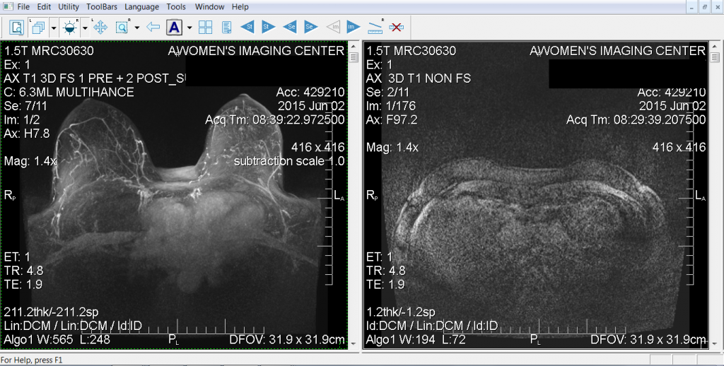 MRI 6-2-15 SAFE